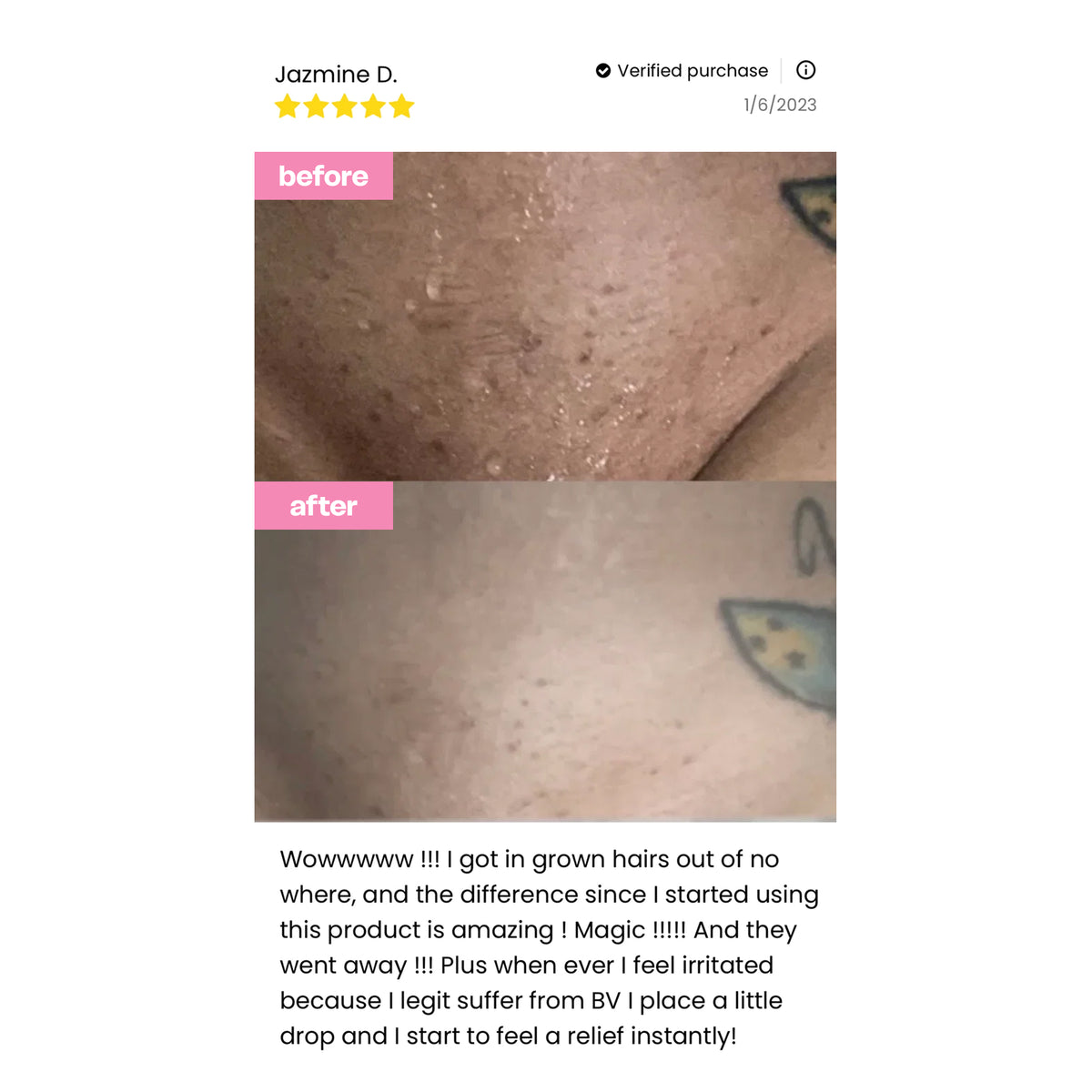 Her Fantasy Box Renew Her Yoni Oil - For Dryness, Ingrown Hair, Dark Marks & Scars