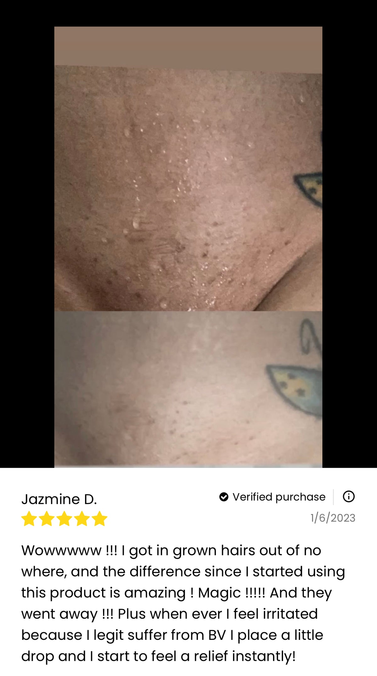 Before and after photos of bikini area showing ingrown hair improvement. 5-star verified review by Jazmine D., 1/6/2023: "Wowwwwww !!! I got in grown hairs out of no where, and the difference since I started using this product is amazing ! Magic !!!!! And they went away !!! Plus when ever I feel irritated because I legit suffer from BV I place a little drop and I start to feel a relief instantly!"